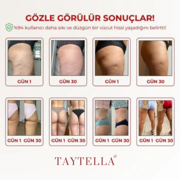 3'lü Etki Taytı Lipödem, Selülit, Varis Marlavé™