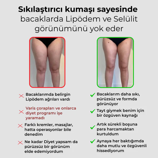 3'lü Etki Taytı Lipödem, Selülit, Varis Marlavé™